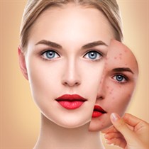 perfect Beauty Selfies logo